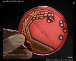 streptococcus equi on blood agar